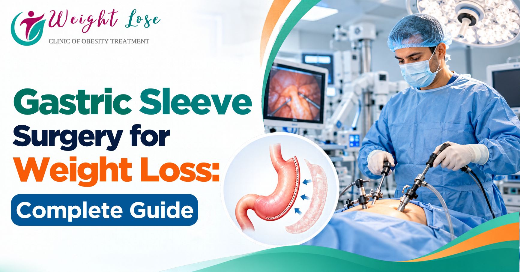 Gastric Sleeve Surgery for Weight Loss: Complete Guide